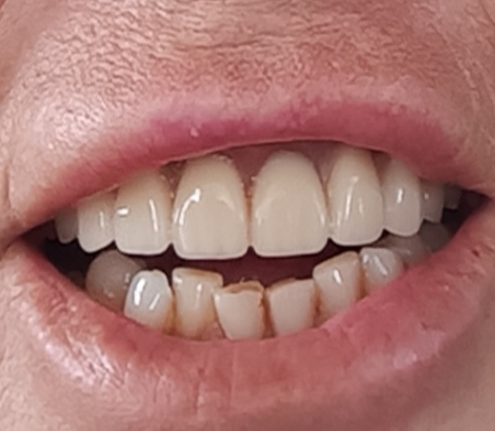 Egremont Dental and Implant Centre