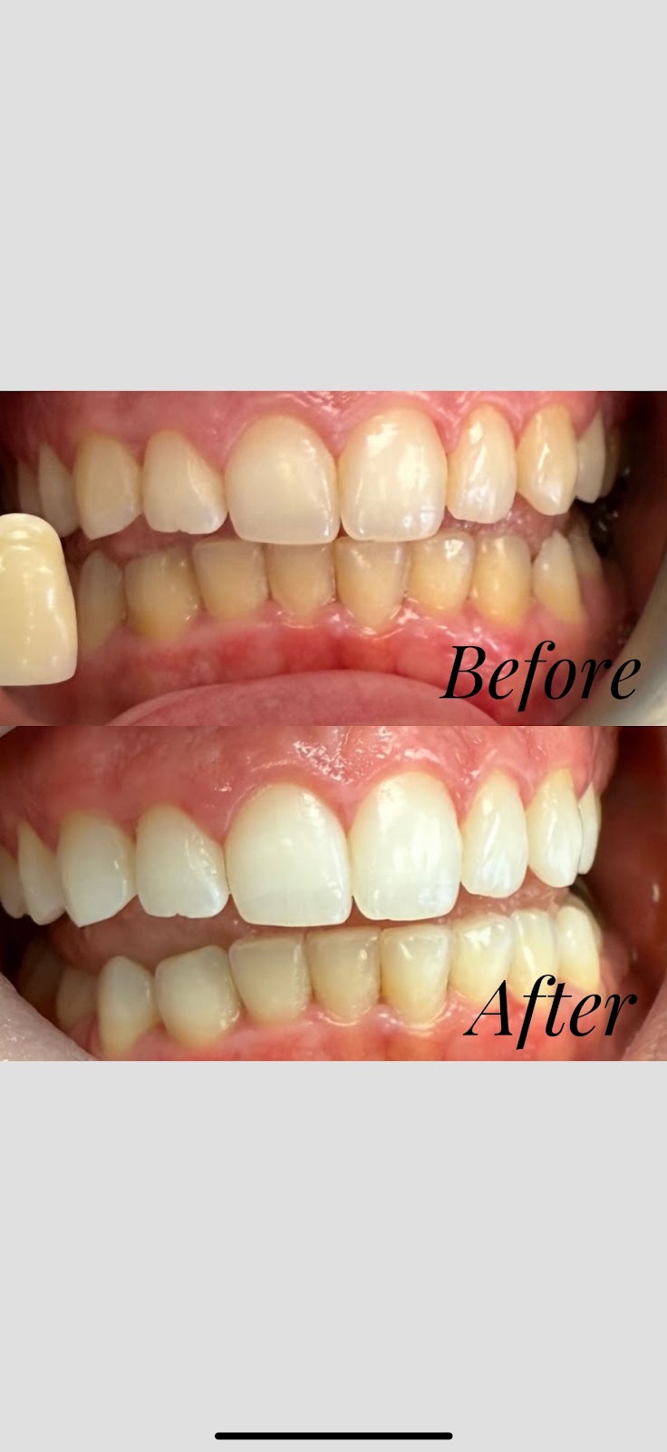 Aesthetic and Implant Dentistry