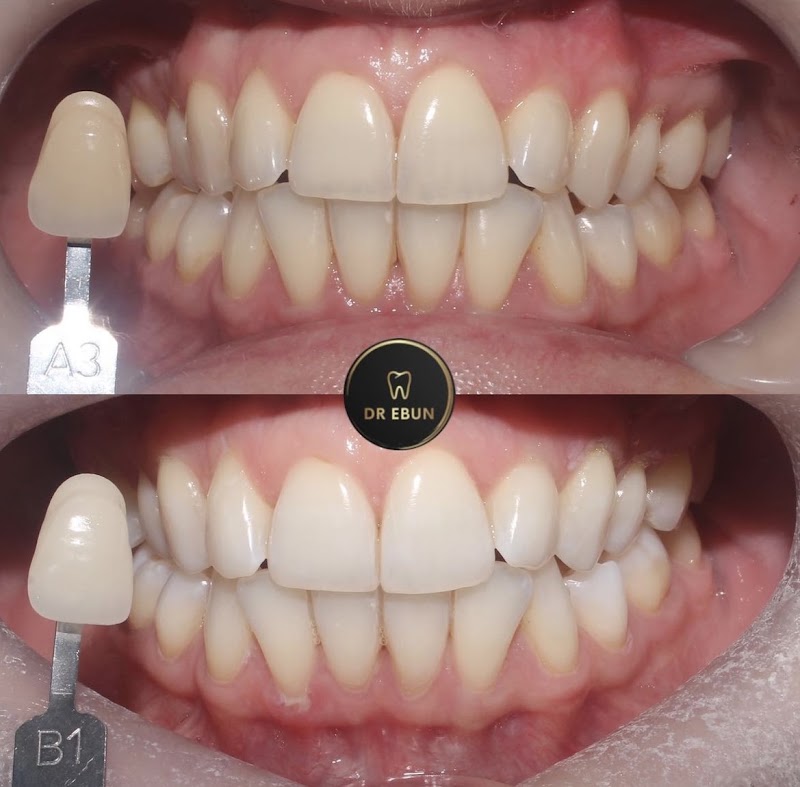 Rainworth Dental Care