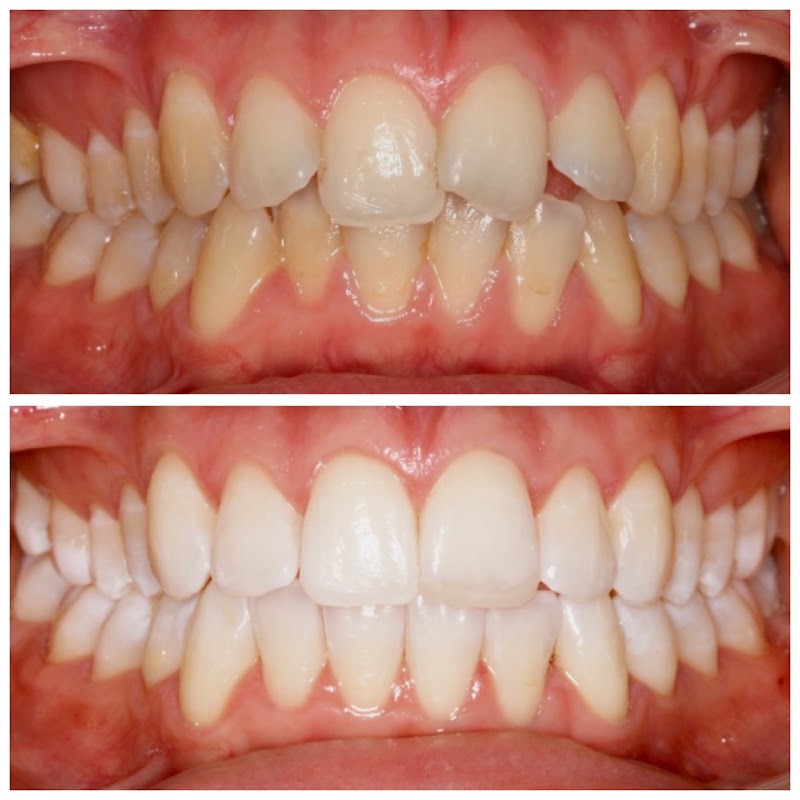 Apollo Dental Health Clinic