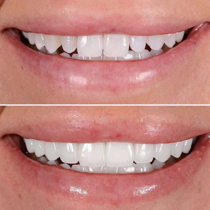 Bespoke Smile