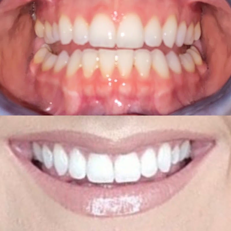Perfect Smile Hoseside Ltd