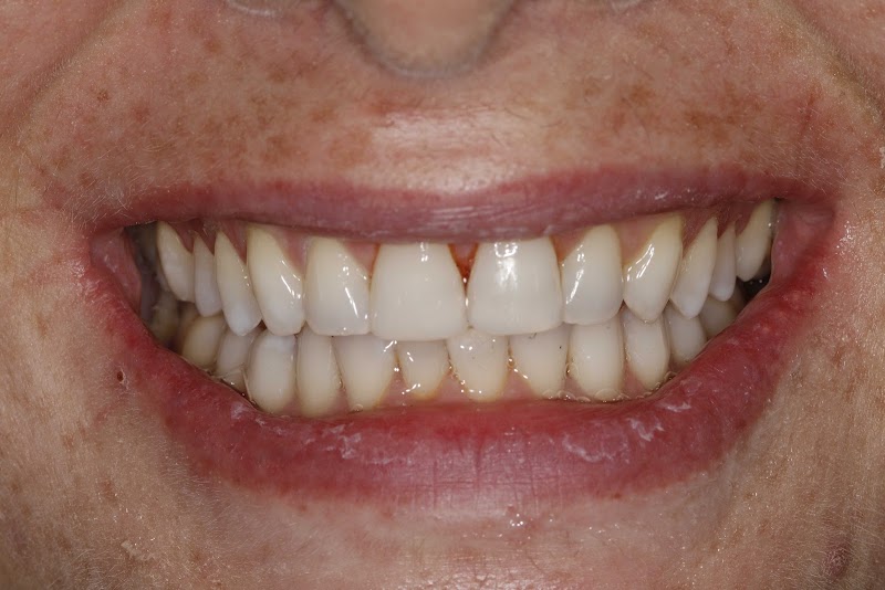 Coach House Dental Practice Limited