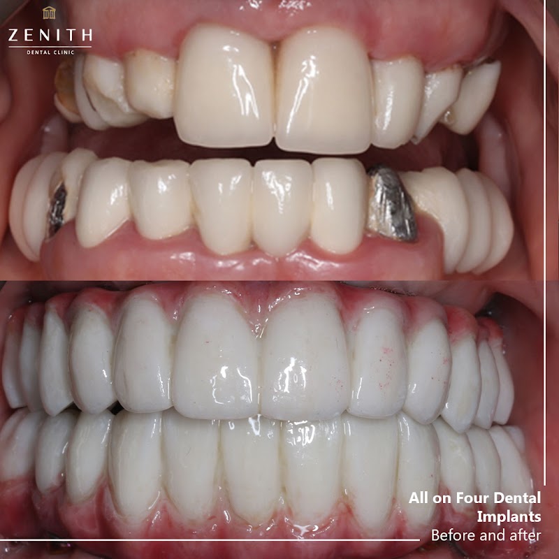 Zenith Dental Clinic Ltd