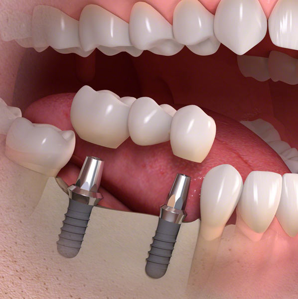 Diamond Dental Studios