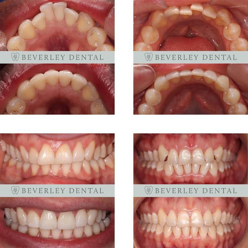 Beverley Dental