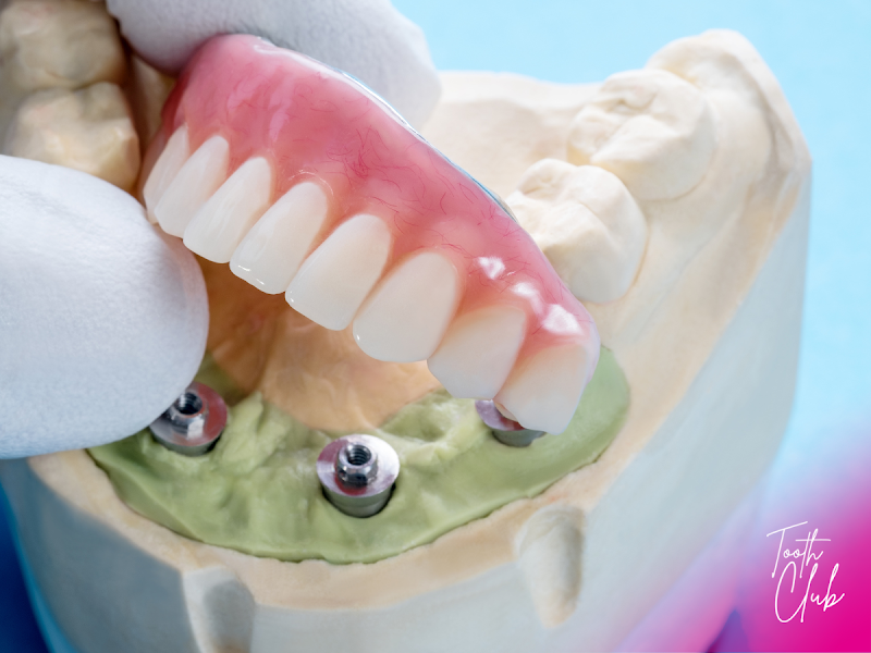 Tooth Club Stratford