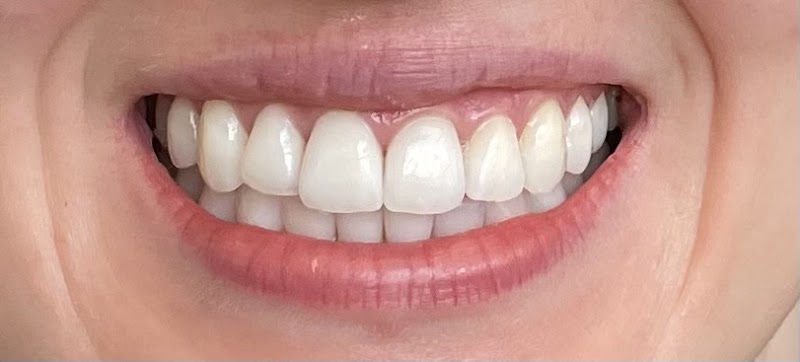 Smile Implant Clinics
