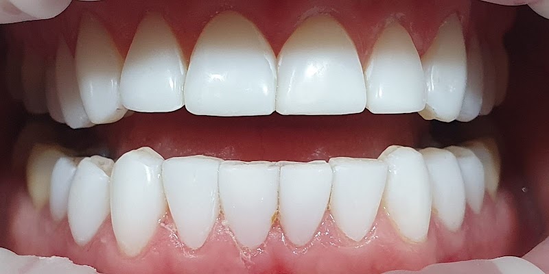 Tooth Club Berkhamsted