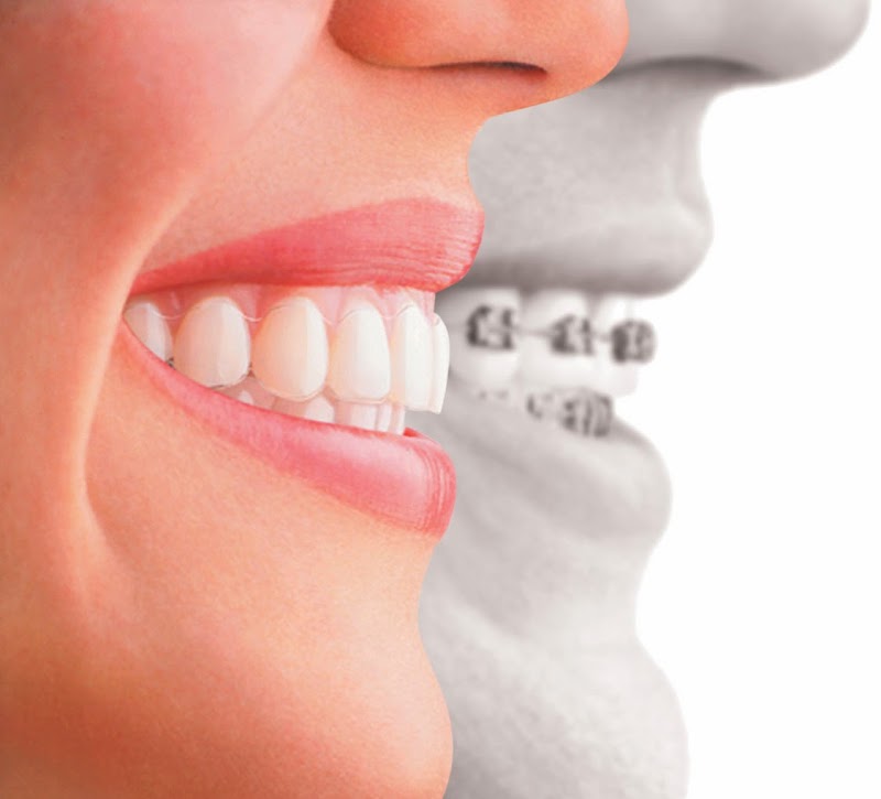 Warrington Dental Care t/a Smilebay