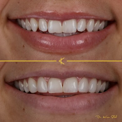 Kalon Dental