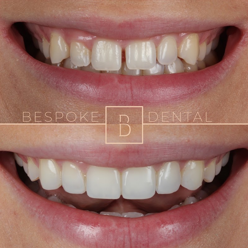 Bespoke Dental