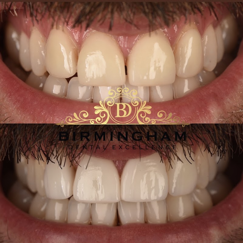 BIRMINGHAM DENTAL EXCELLENCE