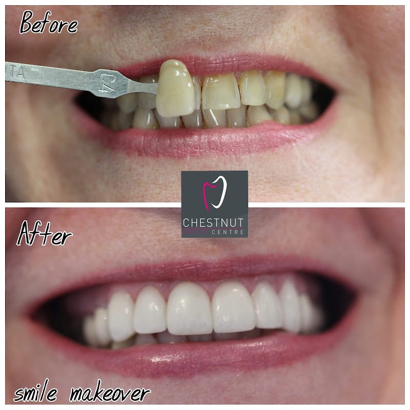 Chestnut Smile Centre