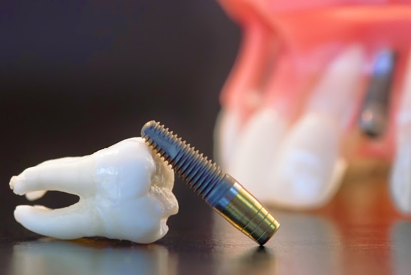 Lovesmile Dental - Implant & Cosmetic Centre