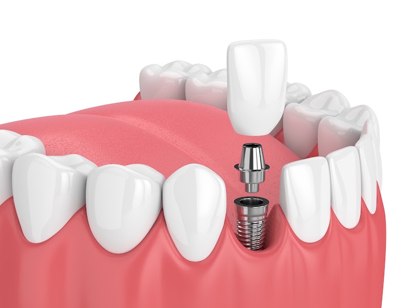 Benfleet Dental Centre