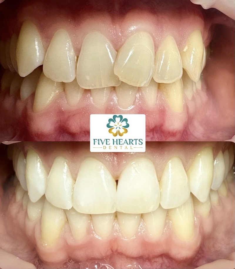 Five Hearts Dental