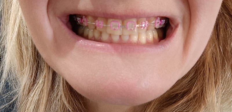 Acorn Orthodontics
