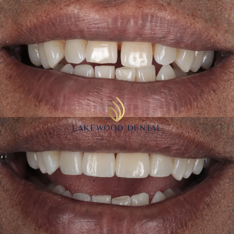 Lakewood Dental