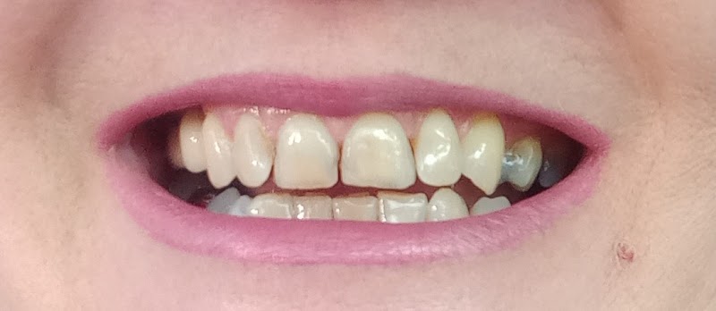 Carlton Dental Care