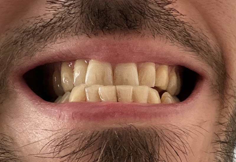 Dental Health Care