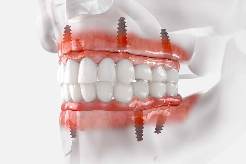 The Implant and Oral Surgery Centre