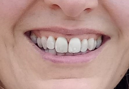 Burpham Dental Care
