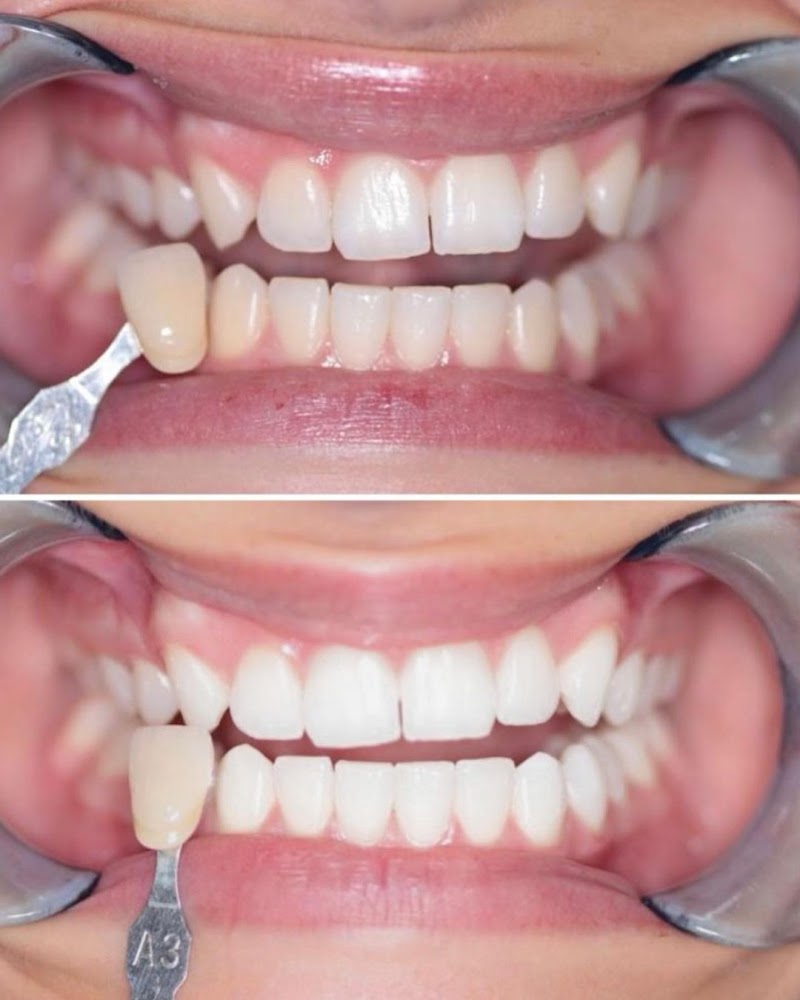 Carlton Dental Practice