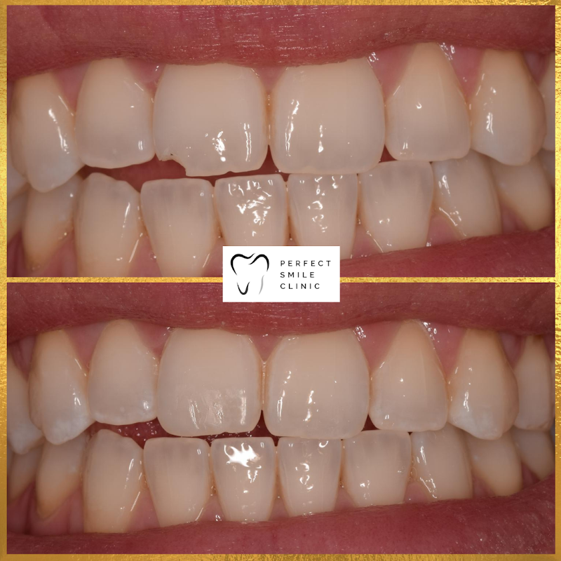 Perfect Smile Clinic