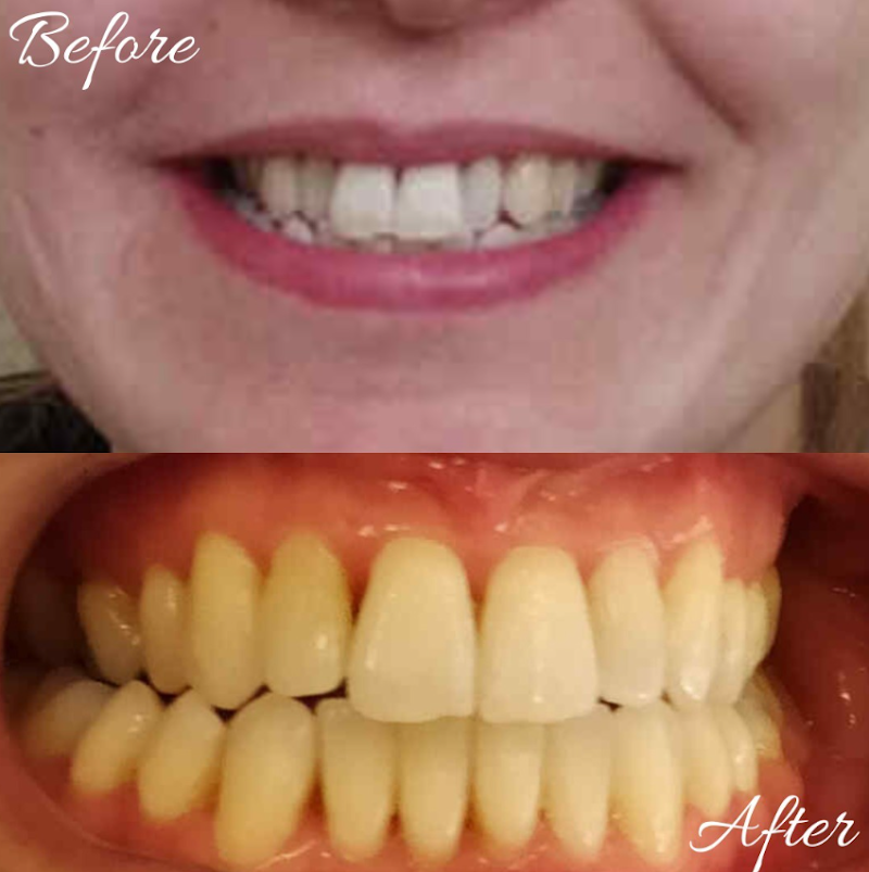 Dental Perfection