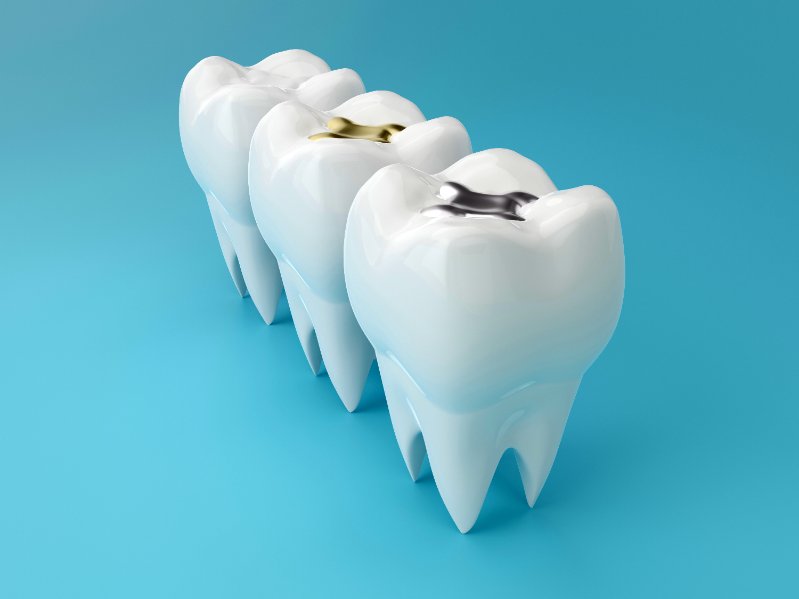 Dental Vision