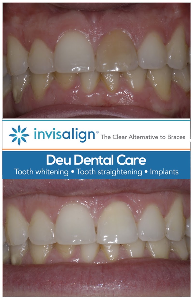 Deu Dental Headingley