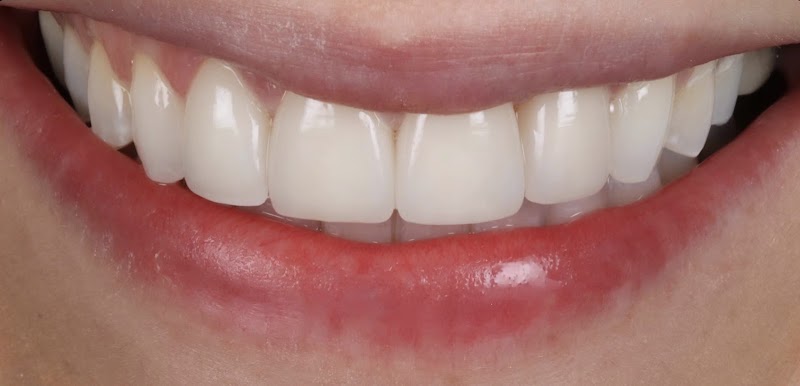 Bupa Dental Care Ladybridge, Bolton