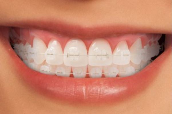 Billericay Orthodontic Practice