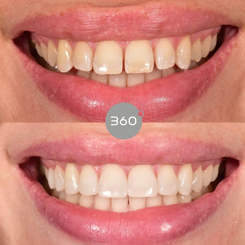 360 Dental Care Limited