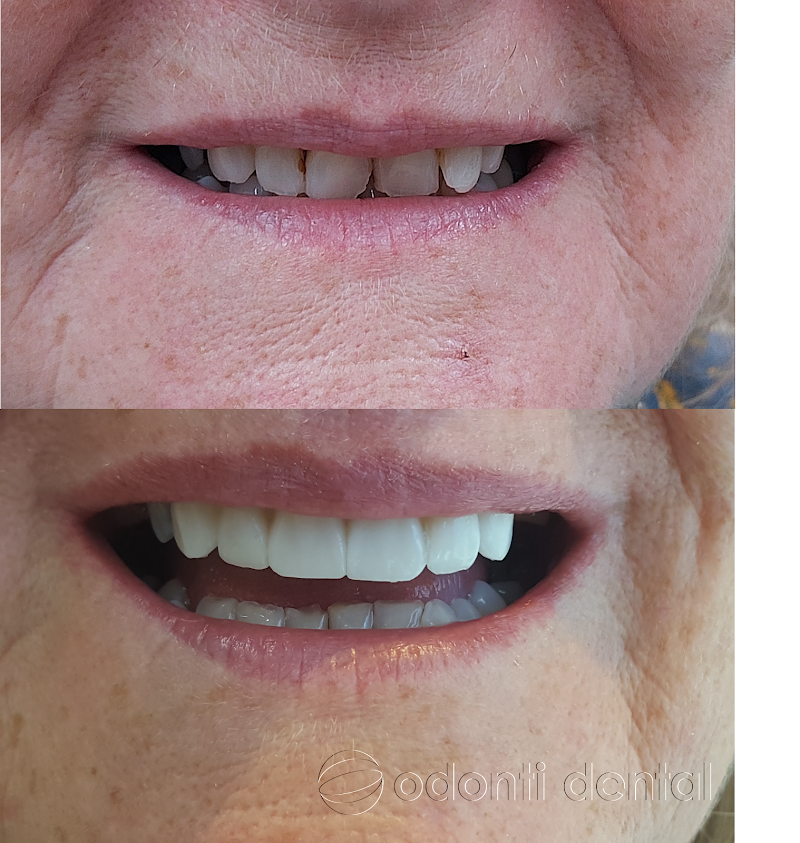 Odonti Dental