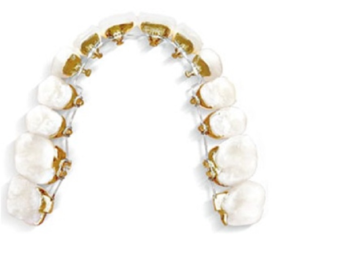 Redhead Orthodontics Portland Place