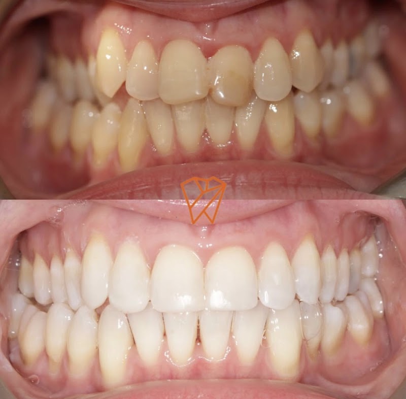 Clayhall Dental Care - Cosmetic & Implant Dentistry