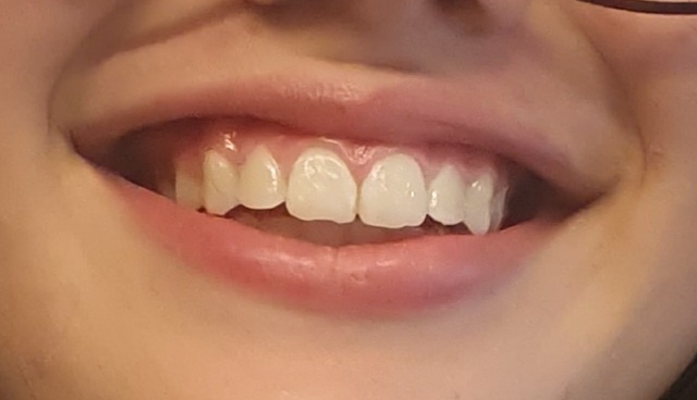 Dental Beauty Benfleet Studio
