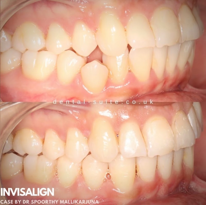The Dental Suite Leicester