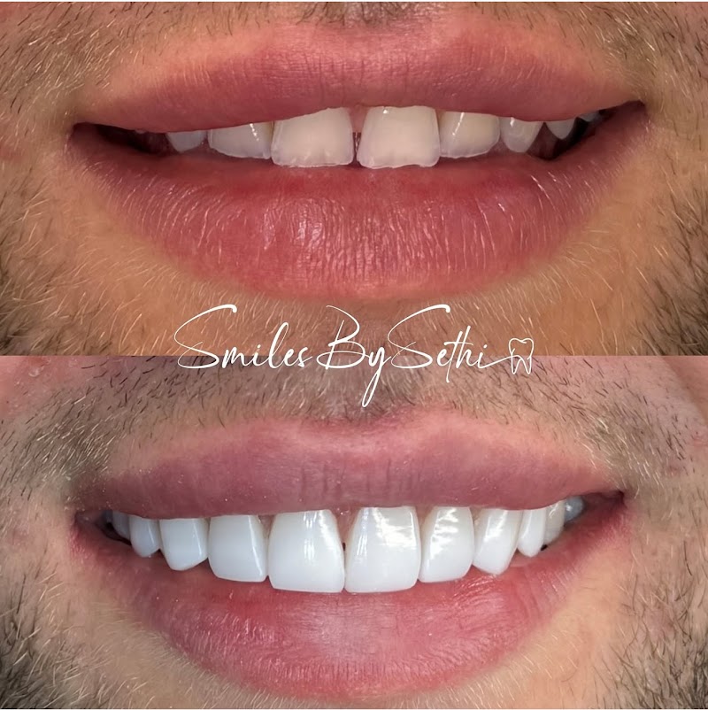 Berkeley Dental x SmilesBySethi