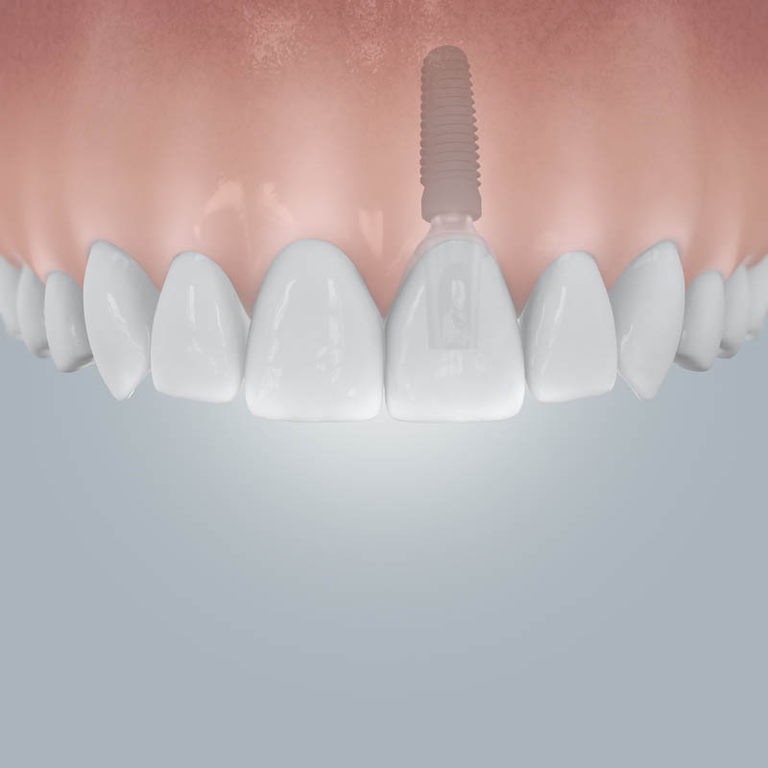 International Dental Centre London