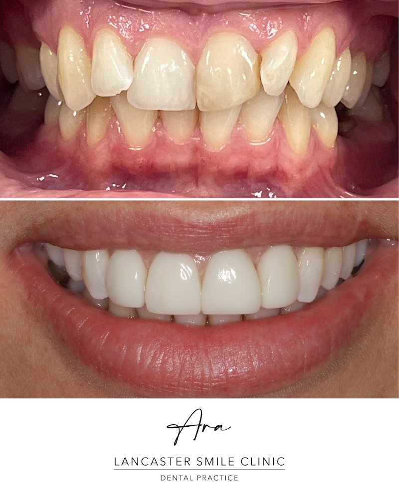Lancaster Smile Clinic