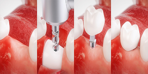 Polski dentysta w Londynie