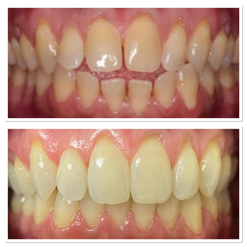 Smile House Dental Practice | Sutton Dentist