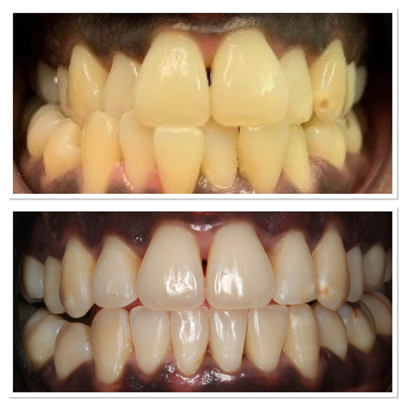 Smile House Dental Practice | Sutton Dentist