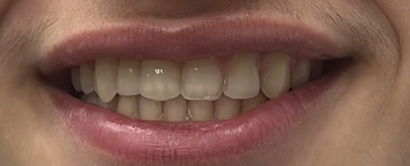 Perfect Smile - Dentist in Ham