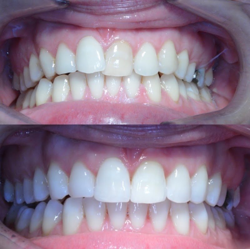 Aveley Dental Practice, Essex