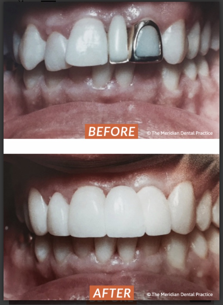 Aveley Dental Practice, Essex