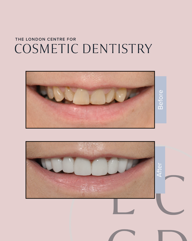The London Centre for Cosmetic Dentistry